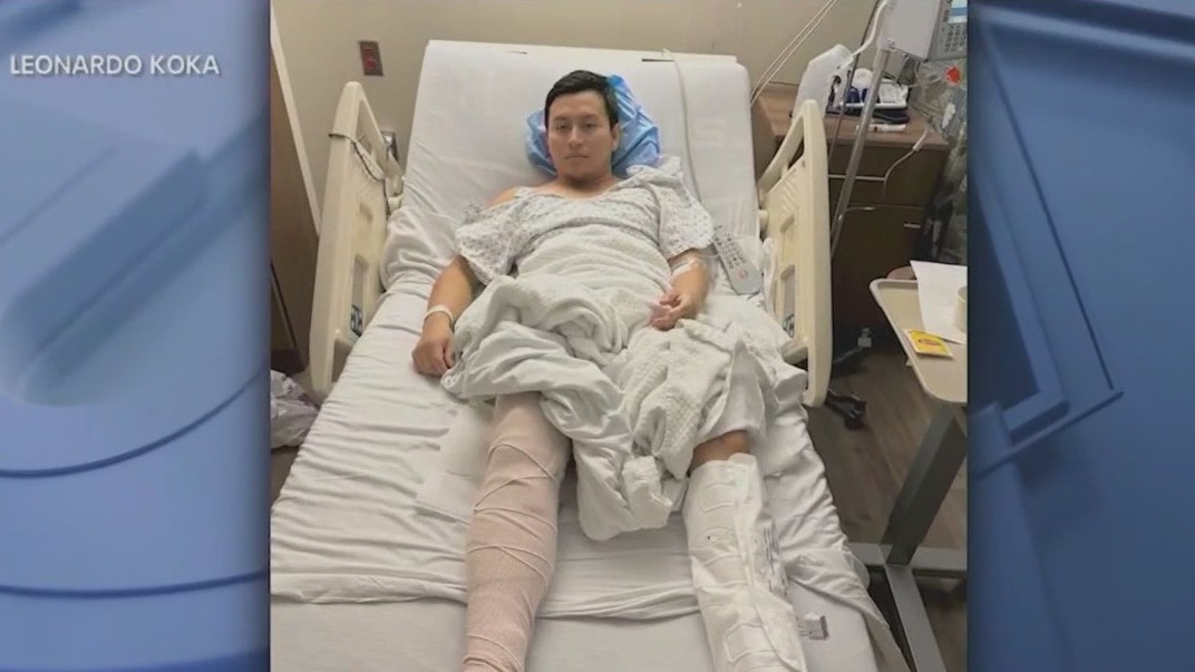 Delivery man hospitalized after being hit by e-bike