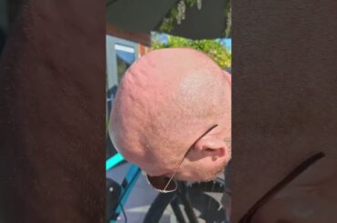 Best Electric Bike Hub Kit? Insane Power & Range! #shorts