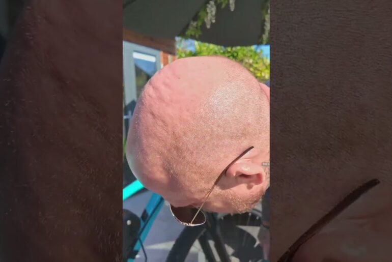 Best Electric Bike Hub Kit? Insane Power & Range! #shorts