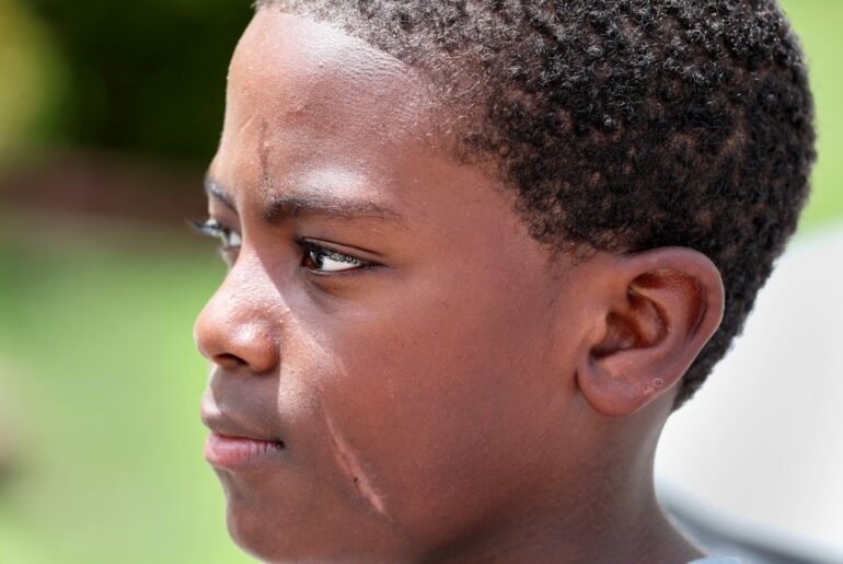 As popularity rises, so do injuries