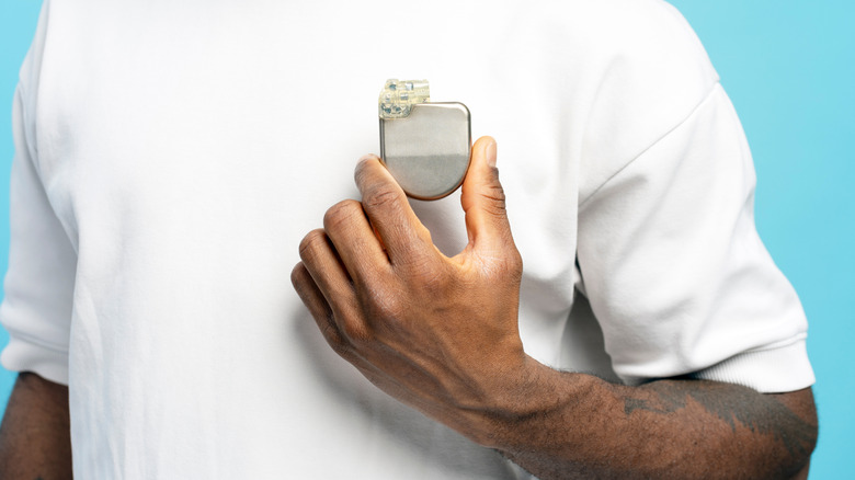 A man holding a pacemaker in front of his chest