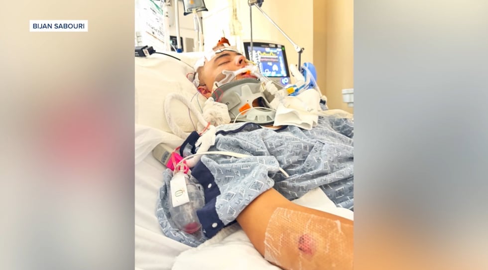 Mark Maldonado, 12, remained in a medically induced coma nearly a week after he was hit by a...